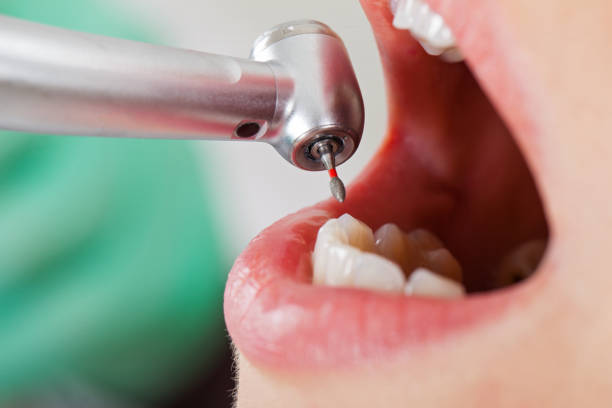 Best Emergency Dental Care for Broken or Chipped Teeth in North Apollo, PA